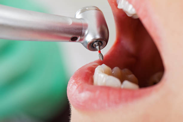 Best Dentist for Dental Trauma  in Seven Mile, AZ